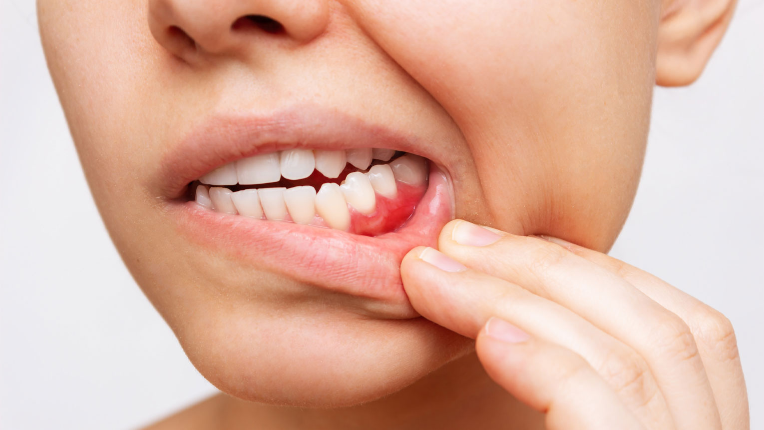 What to Expect During Periodontal Maintenance